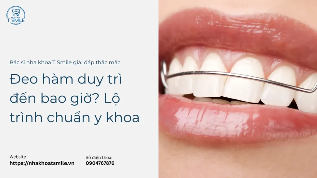 đeo hàm duy trì đến bao giờ