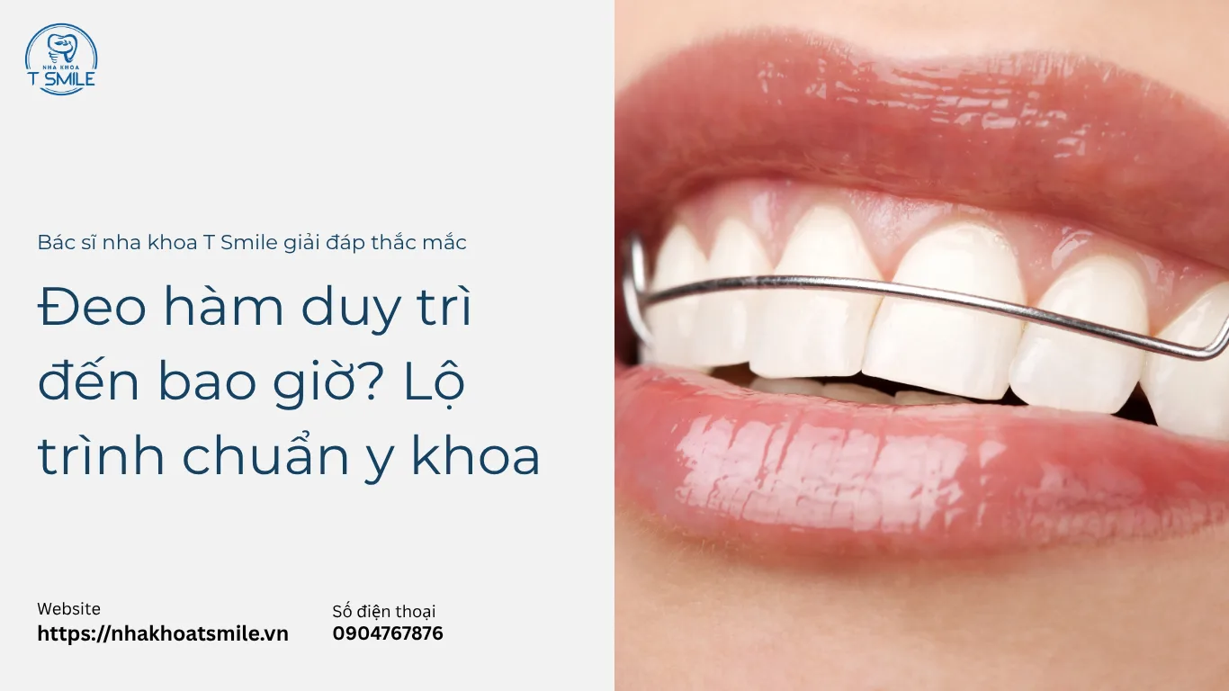 đeo hàm duy trì đến bao giờ