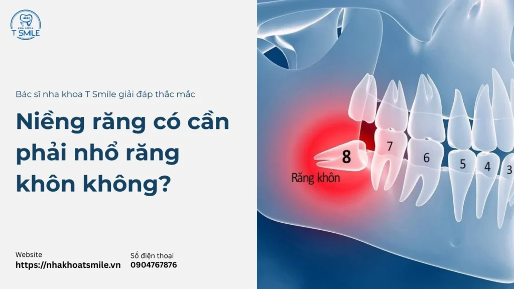 niềng răng có phải nhổ răng khôn không