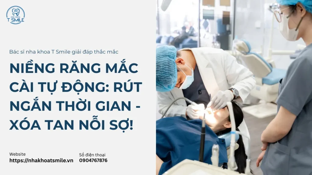 niềng răng mắc cài tự động là gì