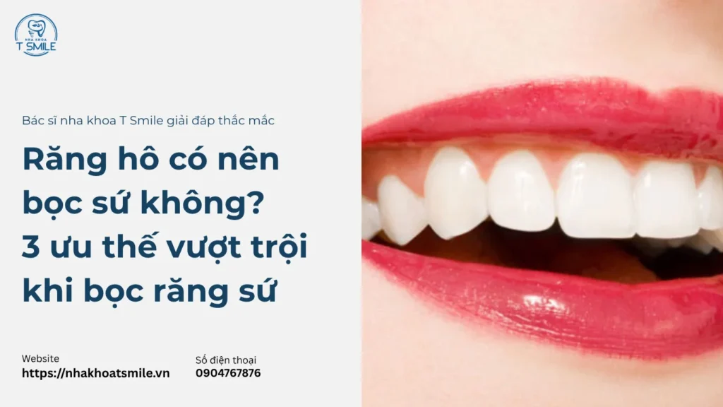 răng hô có nên bọc sứ không