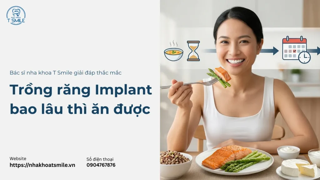 trồng răng implant bao lâu thì ăn được