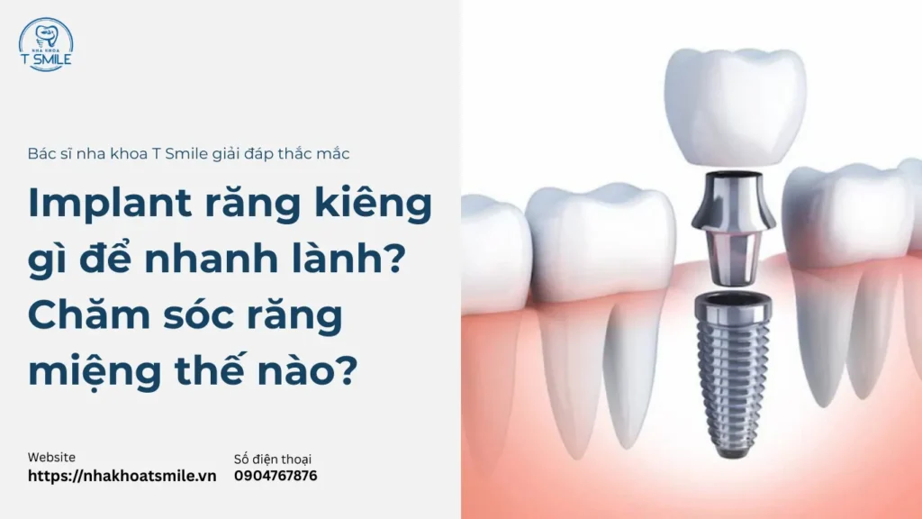 trồng răng implant kiêm ăn gì