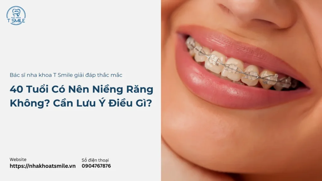 40 tuổi có nên niềng răng không