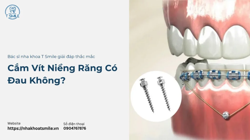 cắm vít niềng răng có đau không