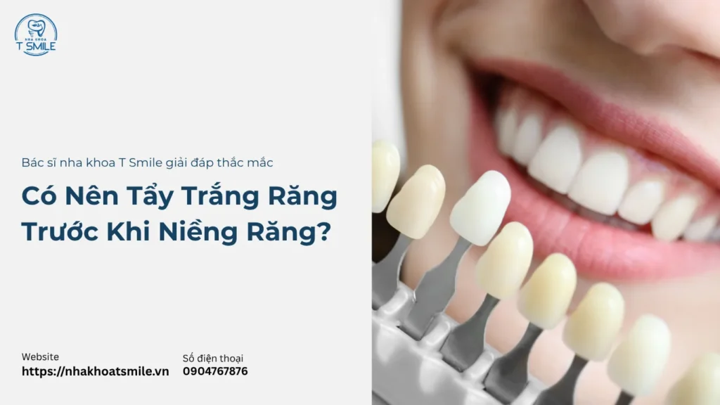 có nên tẩy trắng răng trước khi niềng răng
