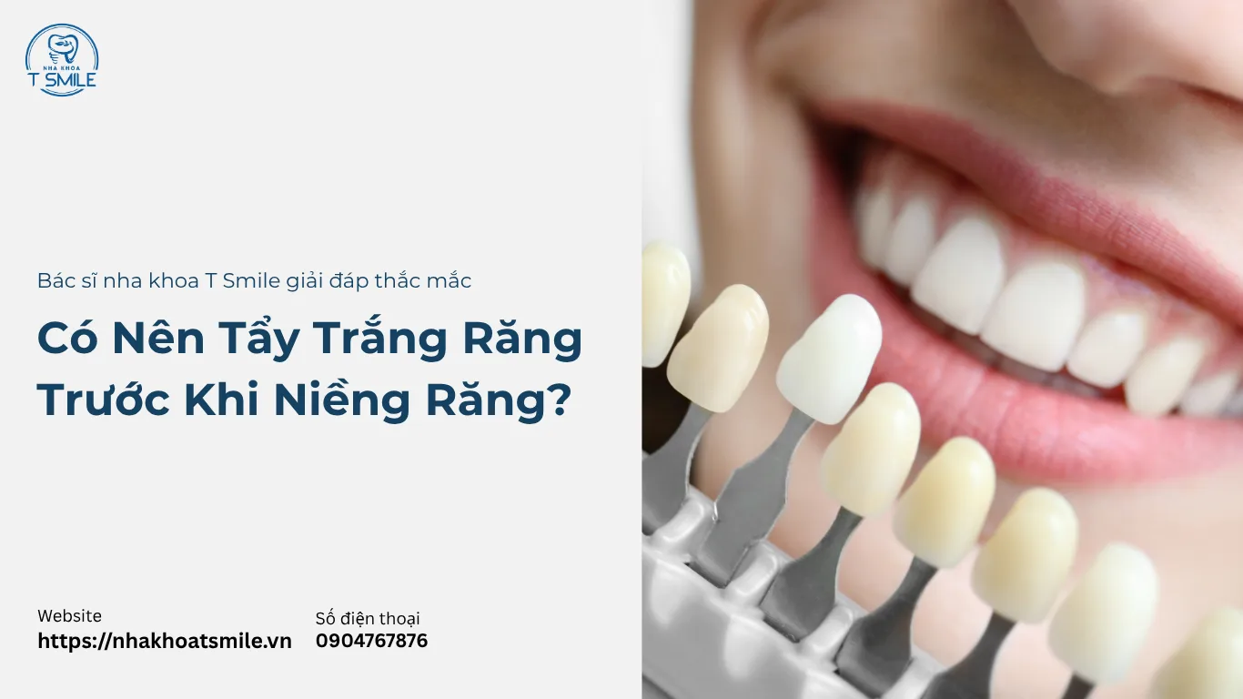 có nên tẩy trắng răng trước khi niềng răng
