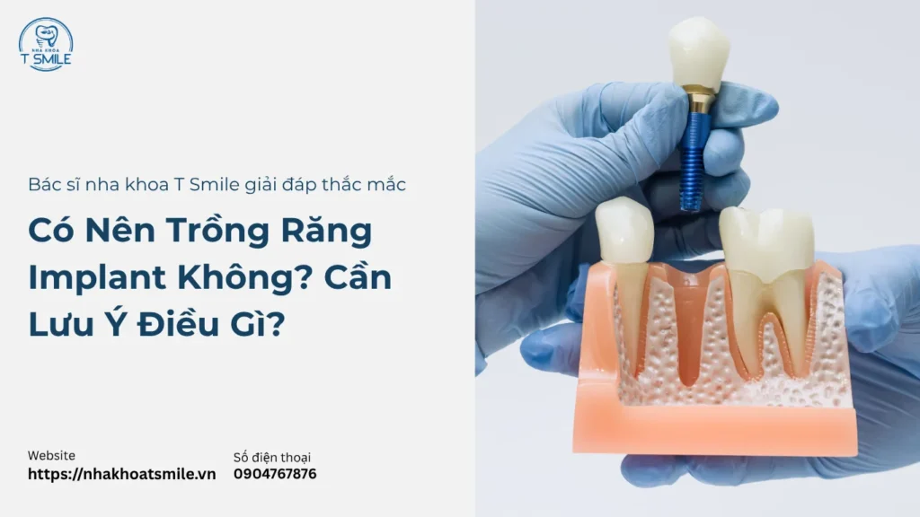 có nên trồng răng implant