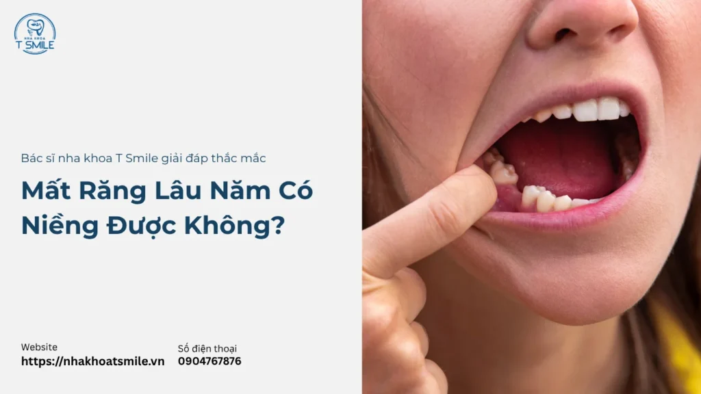 mất răng có niềng được không