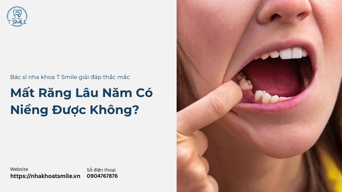 mất răng có niềng được không