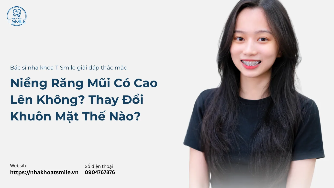 niềng răng mũi có cao lên không