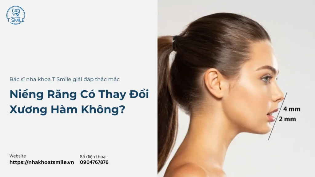 niềng răng có thay đổi xương hàm