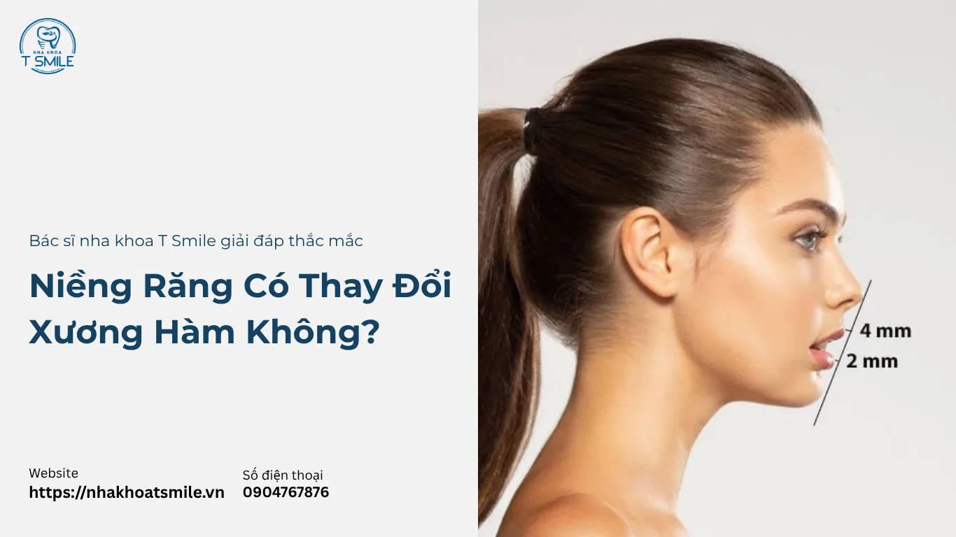 niềng răng có thay đổi xương hàm