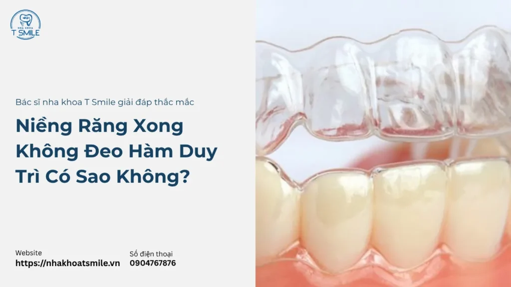 niềng răng xong không đeo hàm duy trì