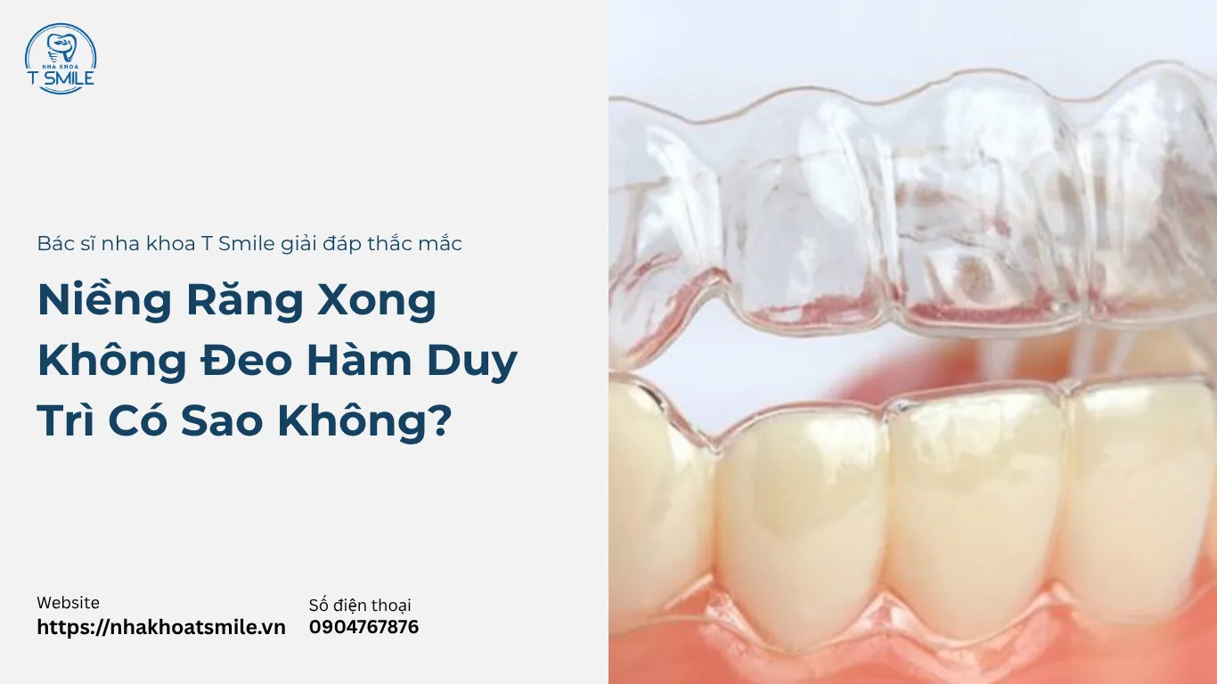 niềng răng xong không đeo hàm duy trì