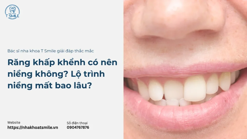 răng khấp khểnh có nên niềng không