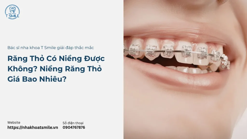 răng thỏ có niềng được không