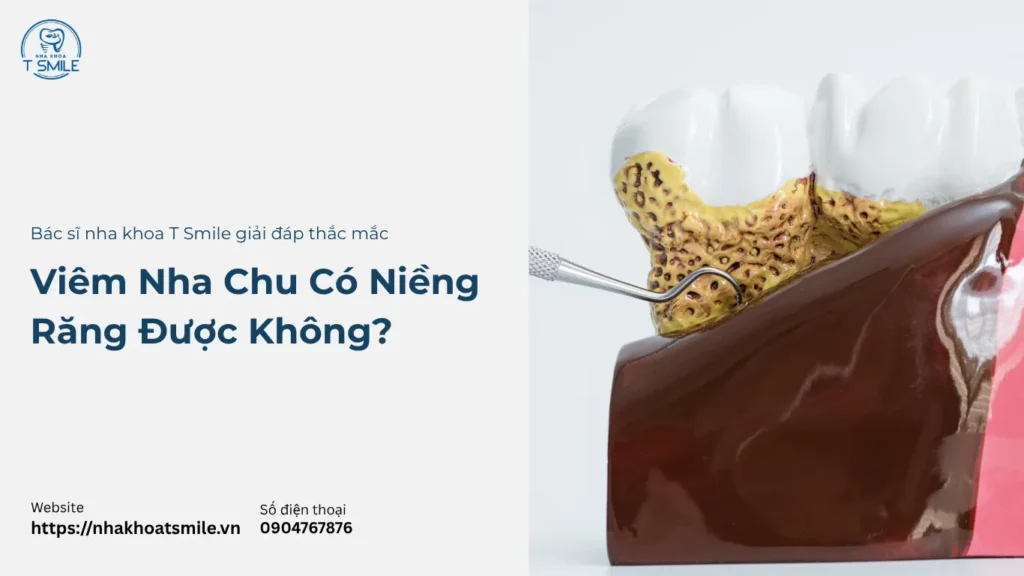 Viêm Nha Chu Có Niềng Răng Được Không?