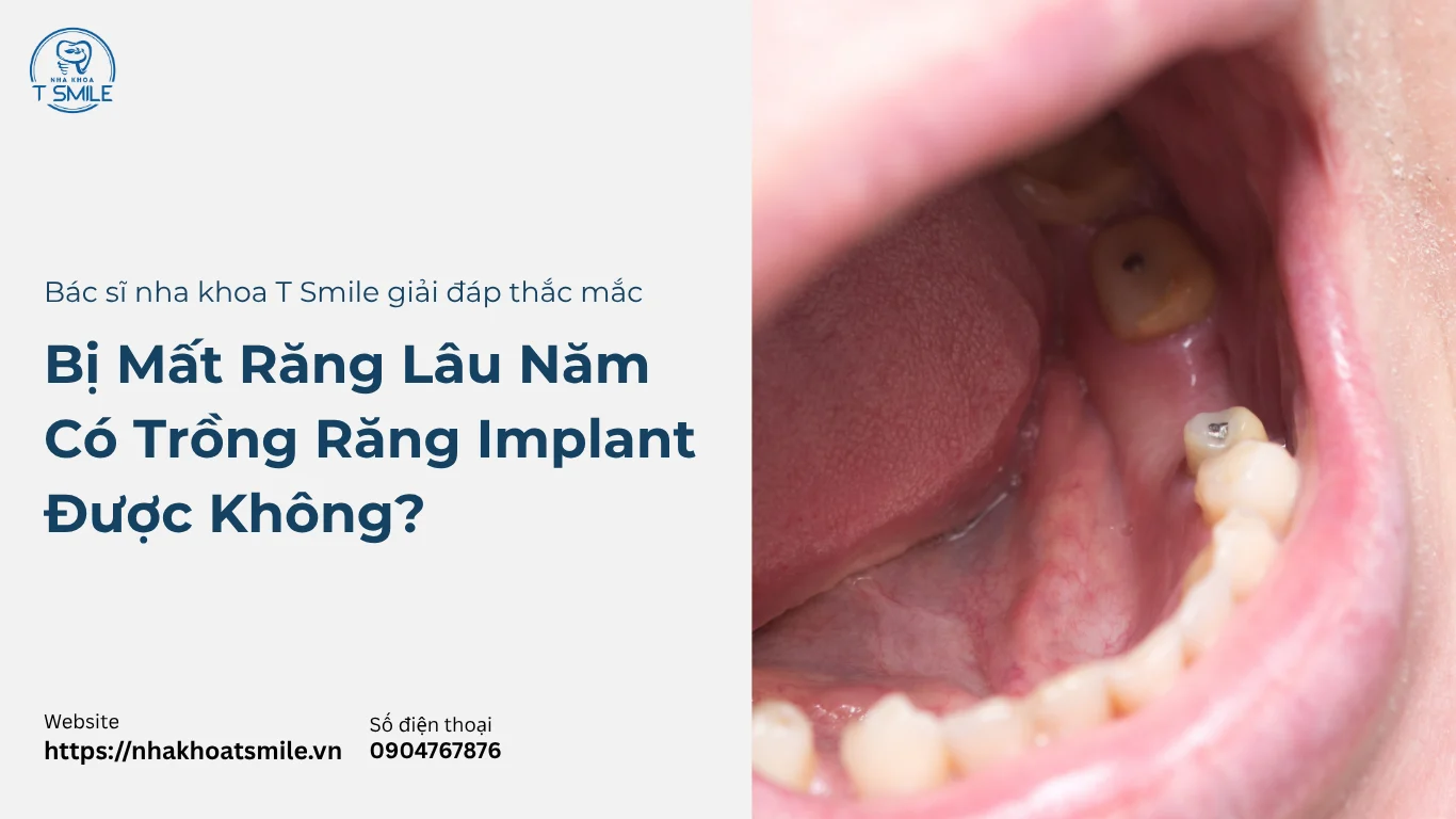 mất răng lâu năm có trồng implant được không