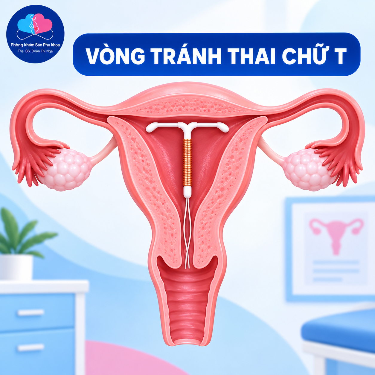 Đặt vòng tránh thai