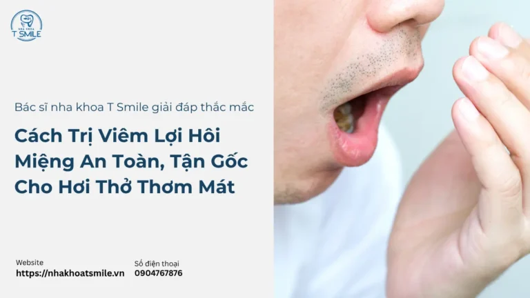 Cách Trị Viêm Lợi Hôi Miệng An Toàn, Tận Gốc Cho Hơi Thở Thơm Mát