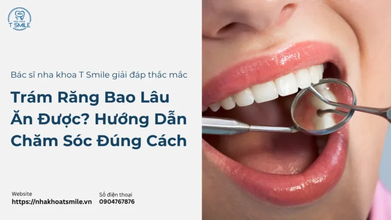 Trám Răng Bao Lâu Ăn Được? Hướng Dẫn Chăm Sóc Đúng Cách