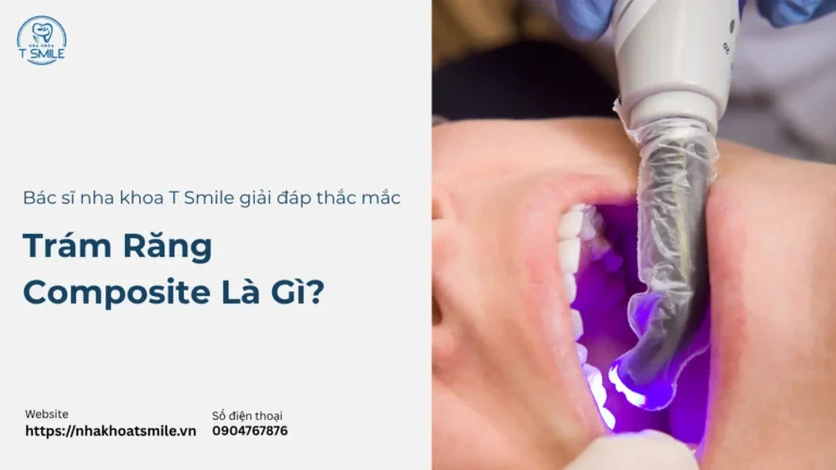 Trám Răng Composite Là Gì? Ưu Điểm, Quy Trình & Chi Phí Chi Tiết