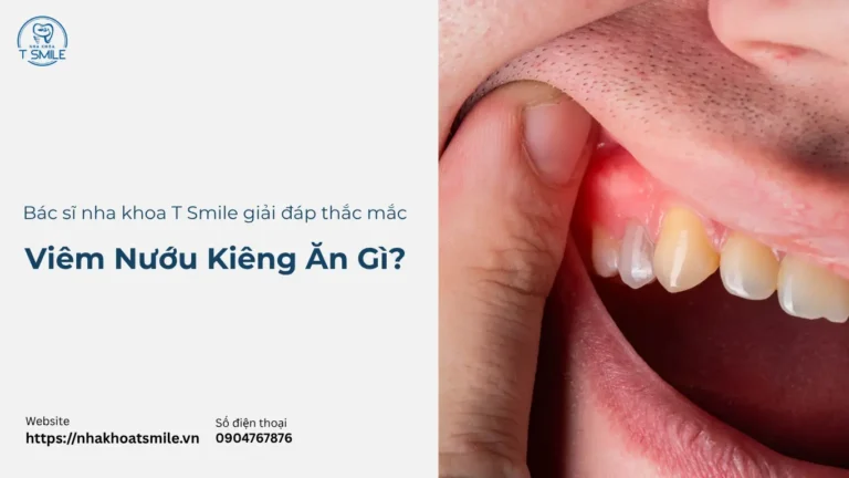 Viêm Nướu Răng Kiêng Ăn Gì? Top 6 Thực Phẩm Cần Tránh Ngay